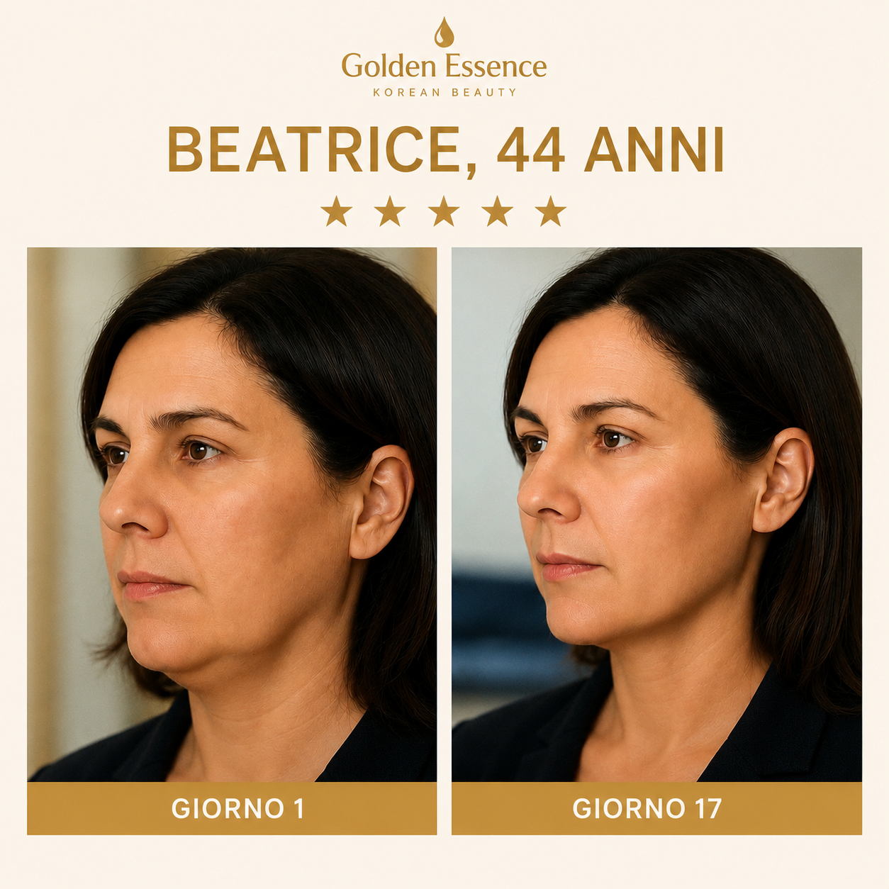 Golden Lift Mask™ - Maschera Viso Rassodante all'Acido Ialuronico Riduttrice del Doppio Mento