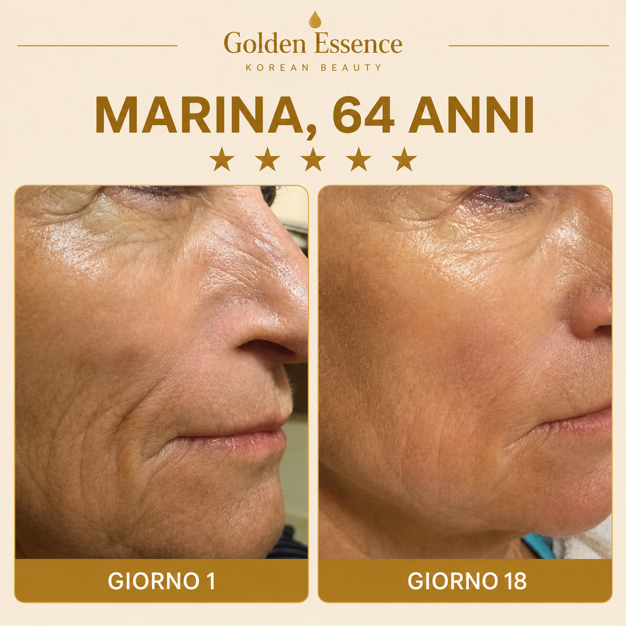 Golden Lift Mask™ - Maschera Viso Rassodante all'Acido Ialuronico Riduttrice del Doppio Mento