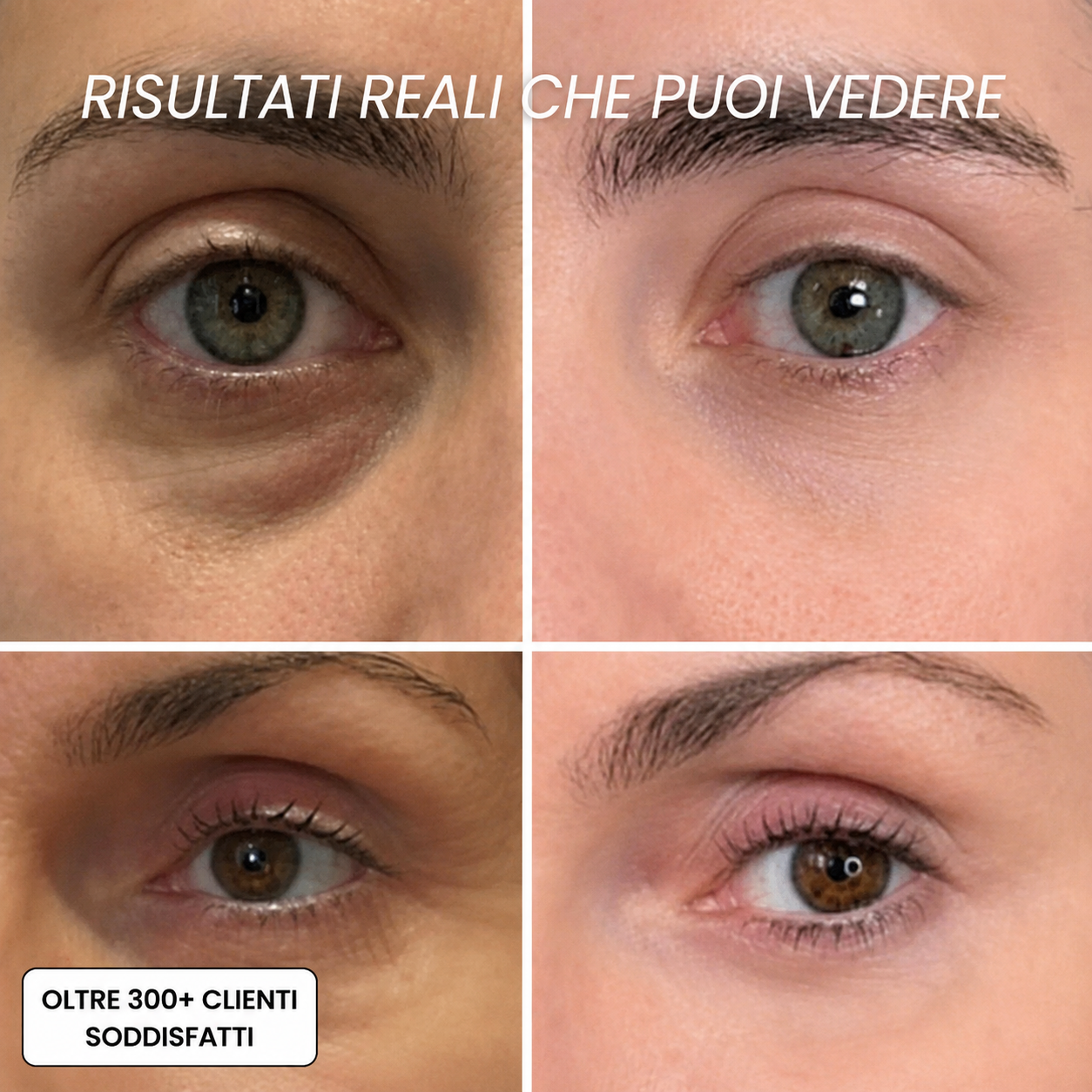 Stick Rimpolpante al Bio-Collagene PDRN