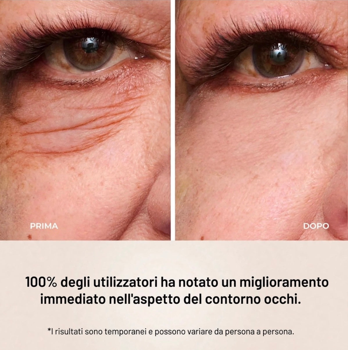 Lift Eye Essence™ - Crema Trattamento Lifting per il Contorno Occhi