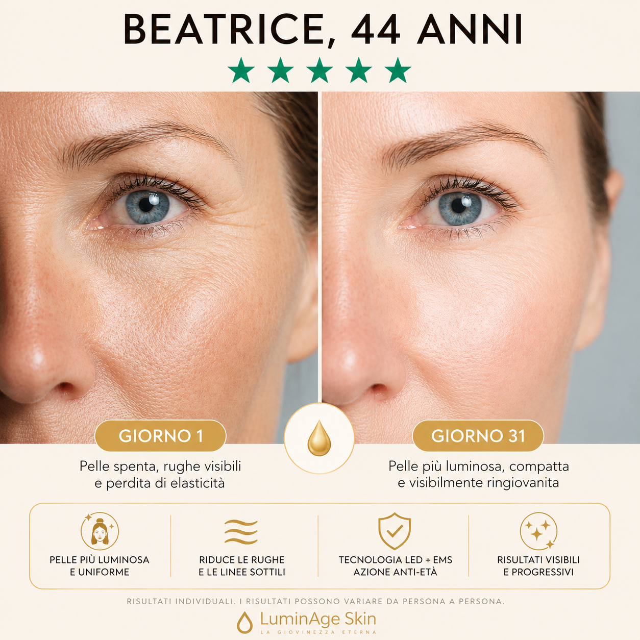 LuminAge Pro – Fototerapia LED Ringiovanente Viso