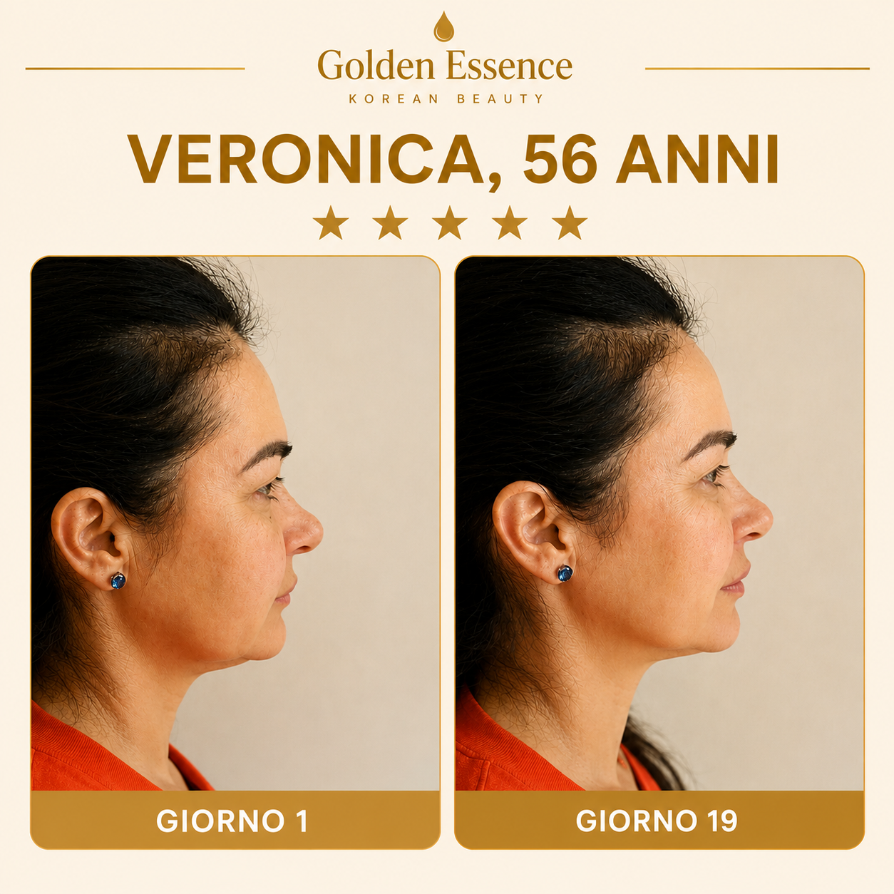 Golden Lift Mask™ - Maschera Viso Rassodante all'Acido Ialuronico Riduttrice del Doppio Mento