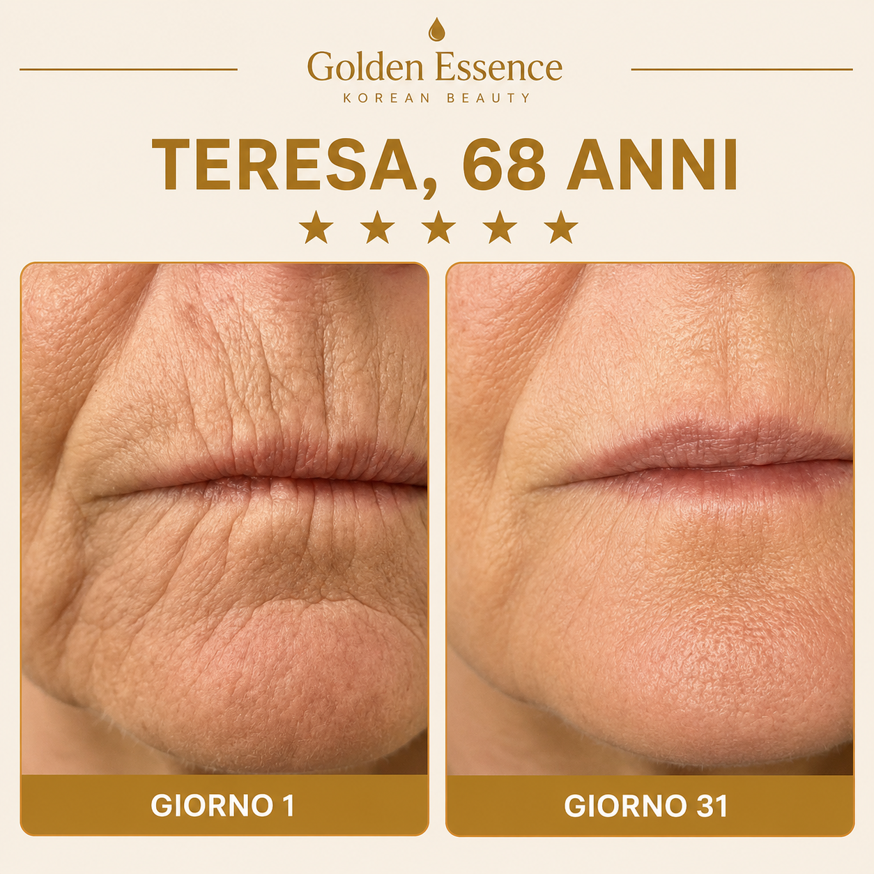 Golden Lift Mask™ - Maschera Viso Rassodante all'Acido Ialuronico Riduttrice del Doppio Mento