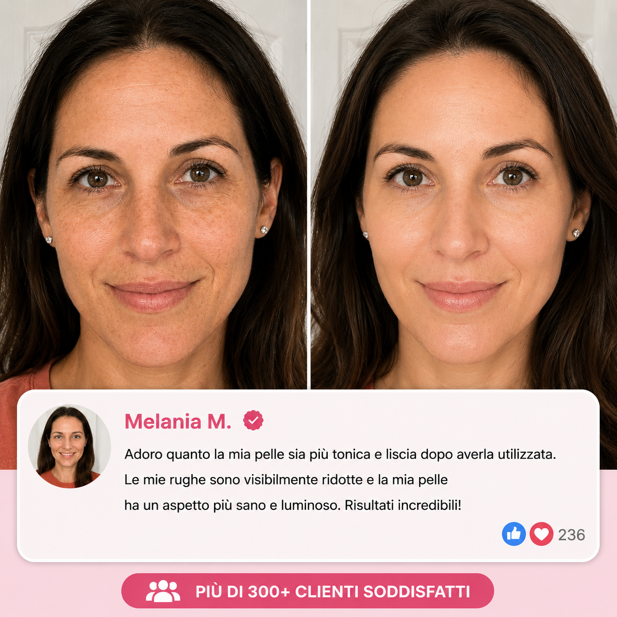 Stick Rimpolpante al Bio-Collagene PDRN