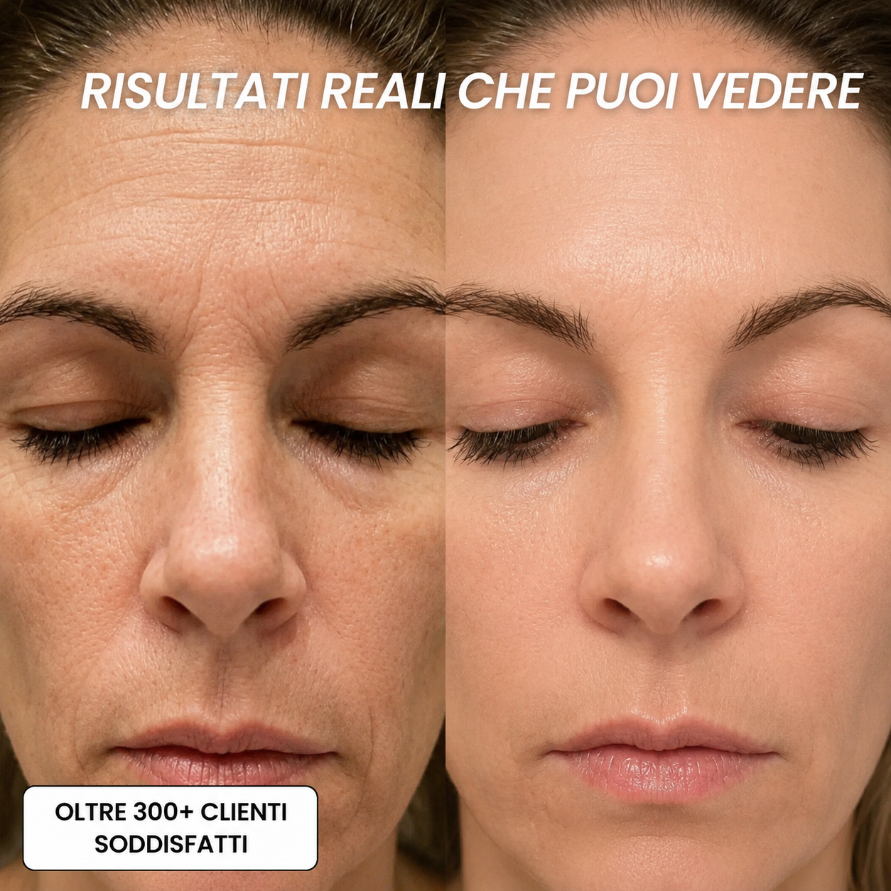 Stick Rimpolpante al Bio-Collagene PDRN